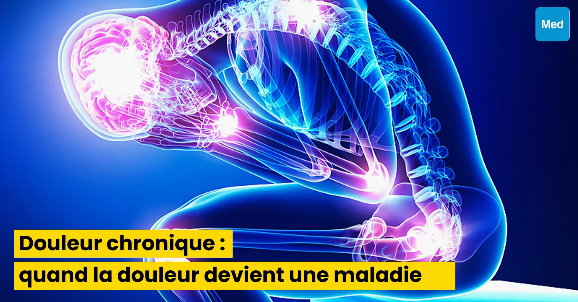 Douleur chronique : quand la douleur devient une maladie